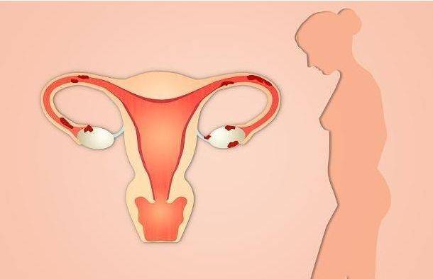 产妇护理全方位指南：女性产养生大放送