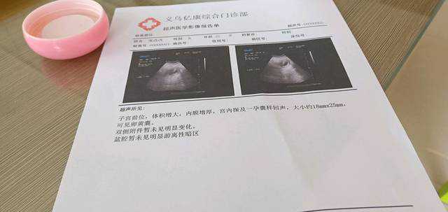 重庆人工助孕医院优缺点分析：揭开真相！